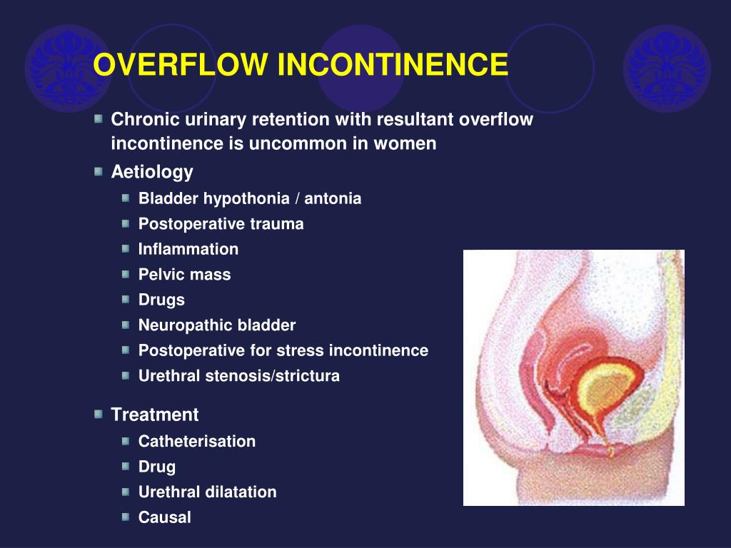 Overflow incontinence treatment guidelines dikiivy
