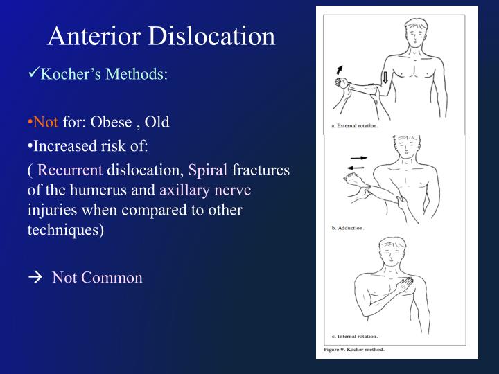 PPT Shoulder Dislocation PowerPoint Presentation ID4841498