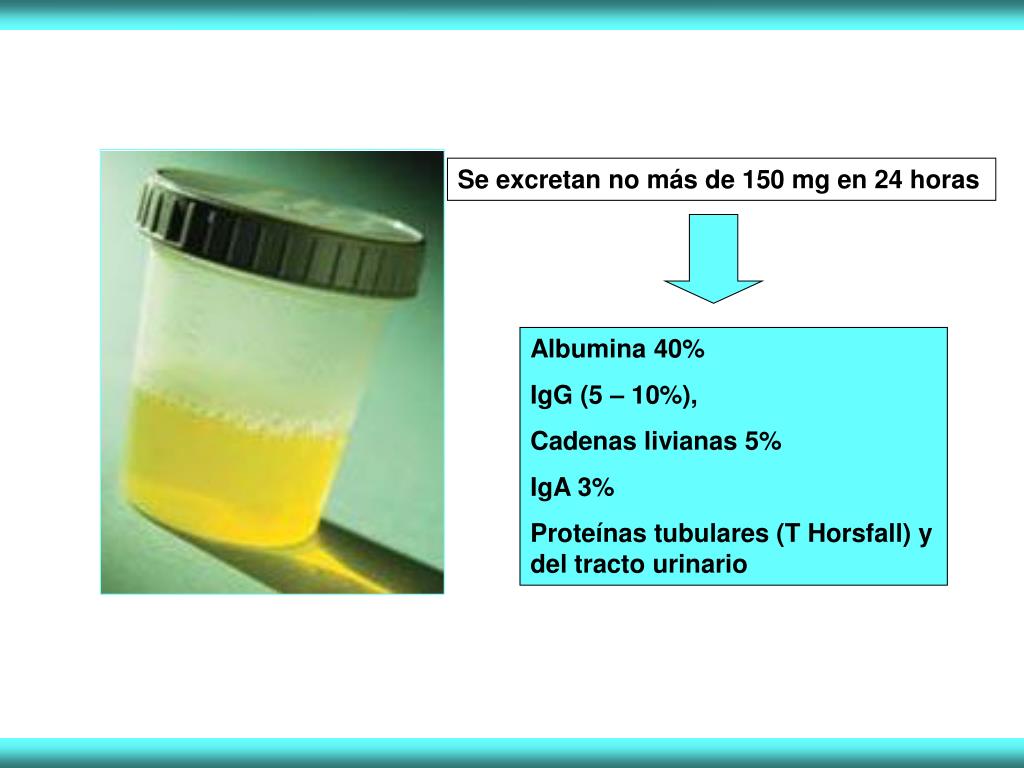 PPT Proteinuria y Hematuria PowerPoint Presentation, free download