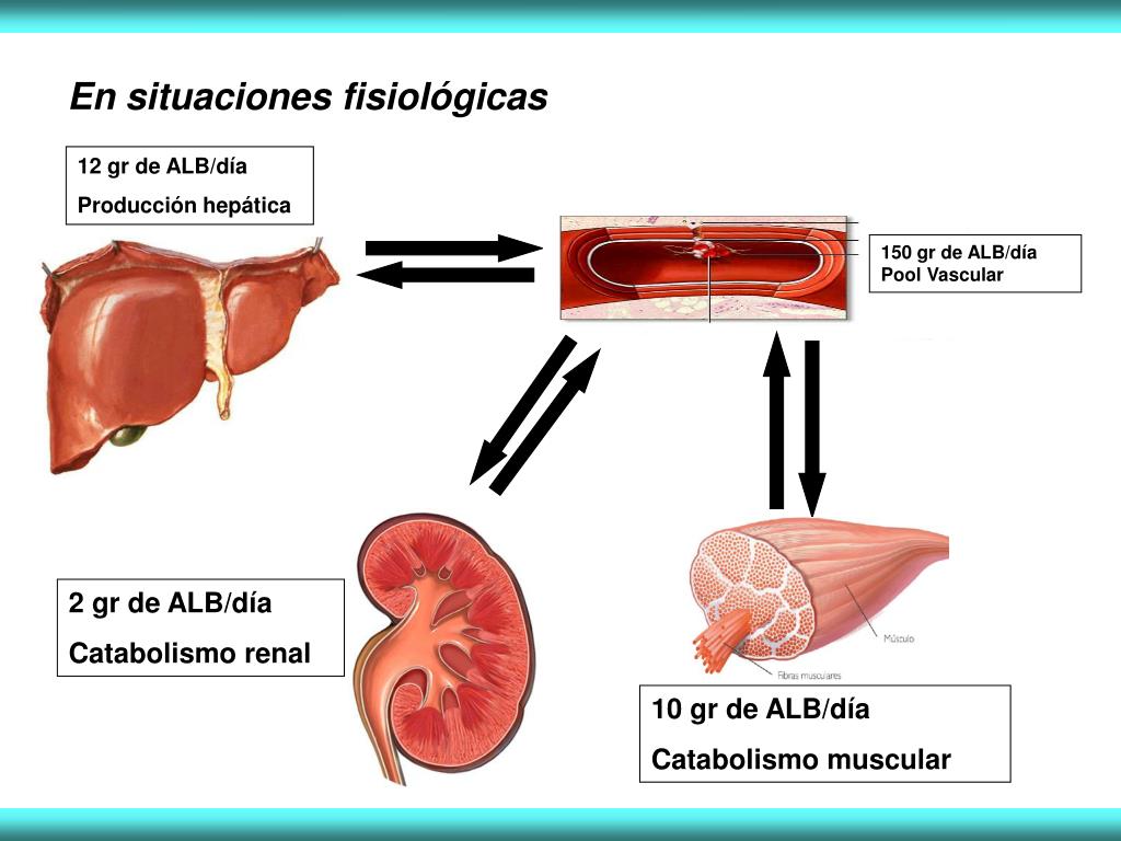 PPT Proteinuria y Hematuria PowerPoint Presentation, free download