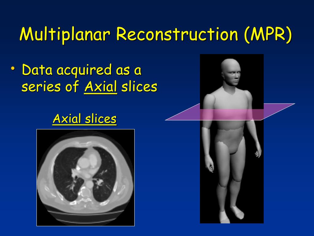PPT PAM2003 Lecture 5 Computed Tomography II PowerPoint Presentation