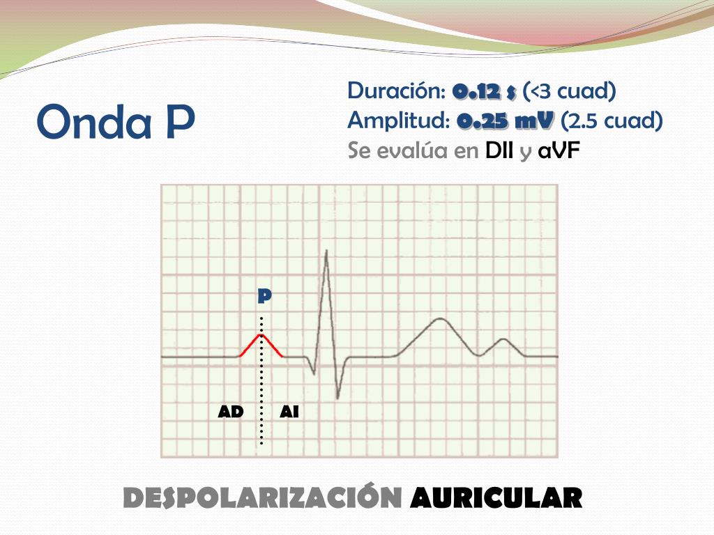 PPT INTERPRETACION BÁSICA DE ELECTROCARDIOGRAMA PowerPoint