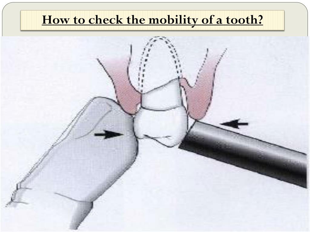 PPT CLINICAL EXAMINATION AND DIAGNOSIS PowerPoint Presentation, free