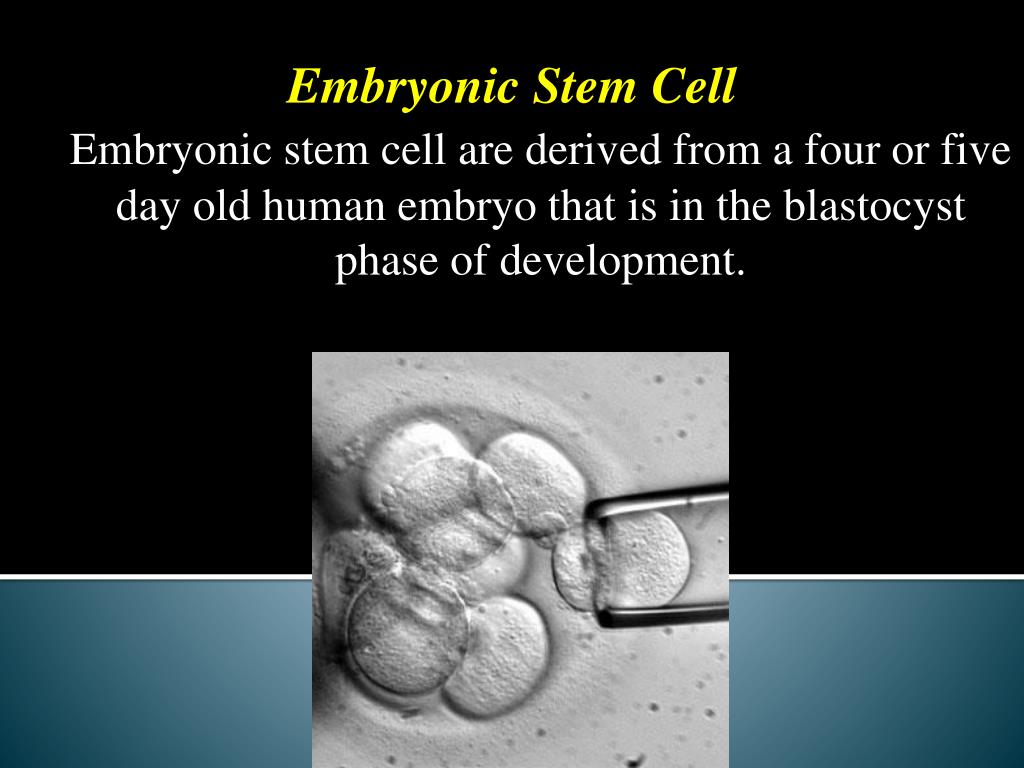 PPT Stem Cell PowerPoint Presentation, free download ID4875198