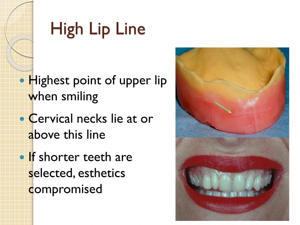 PPT Prof.Dr. Ahlam El Sharkawy Head of prosthodontic departement