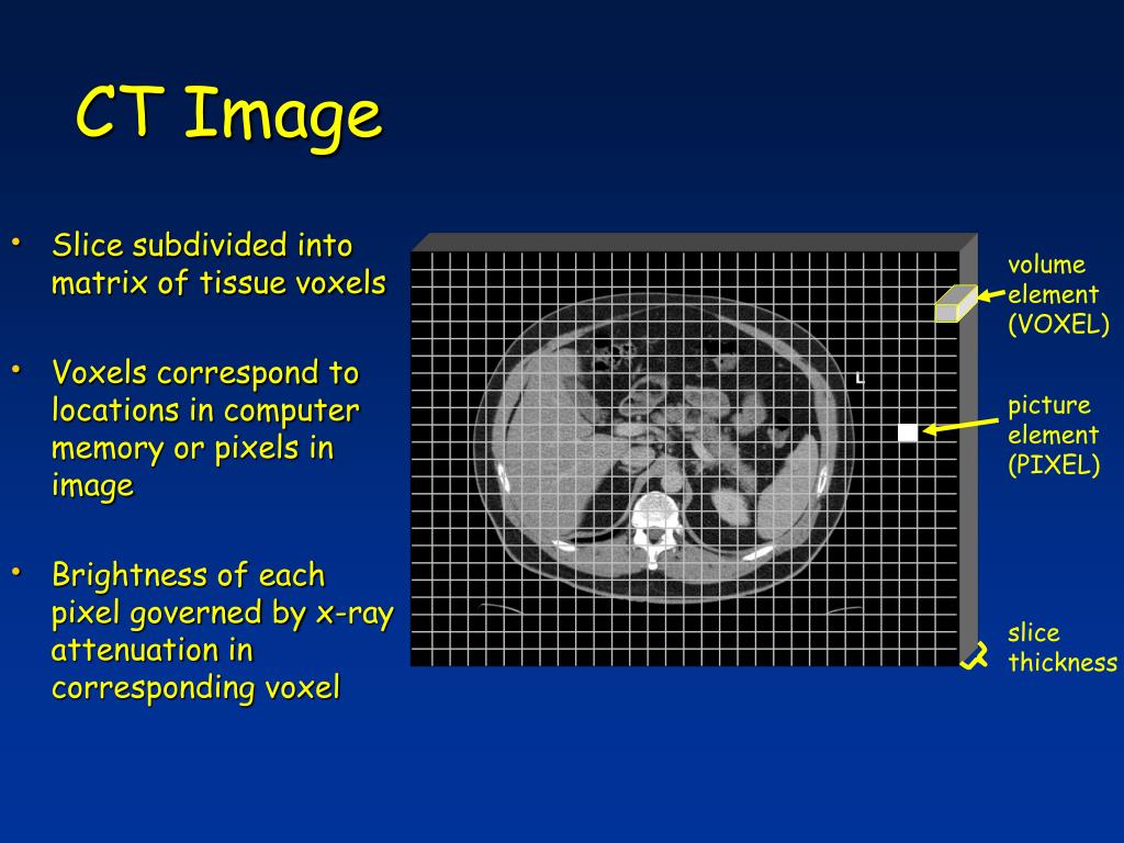 PPT PAM 2003 Lecture 4 Computed Tomography I PowerPoint Presentation