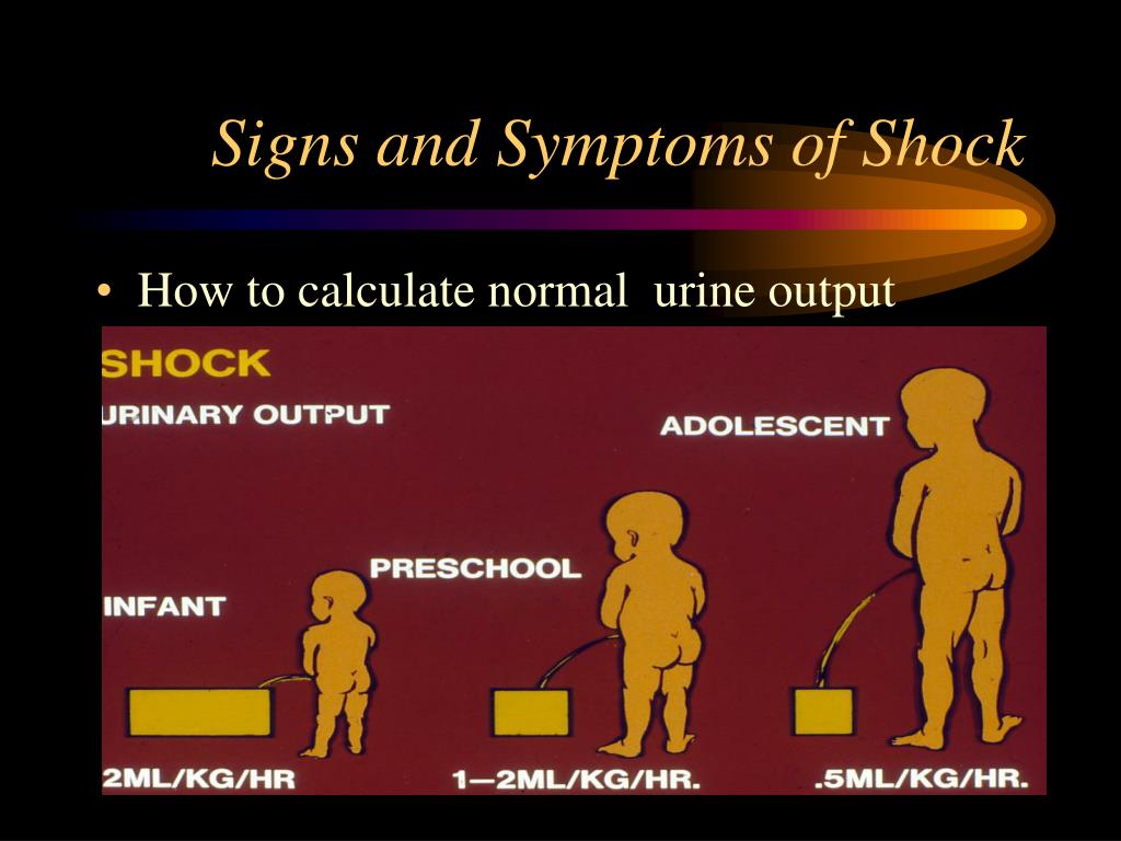 PPT Recognizing Shock PowerPoint Presentation, free download ID4918943