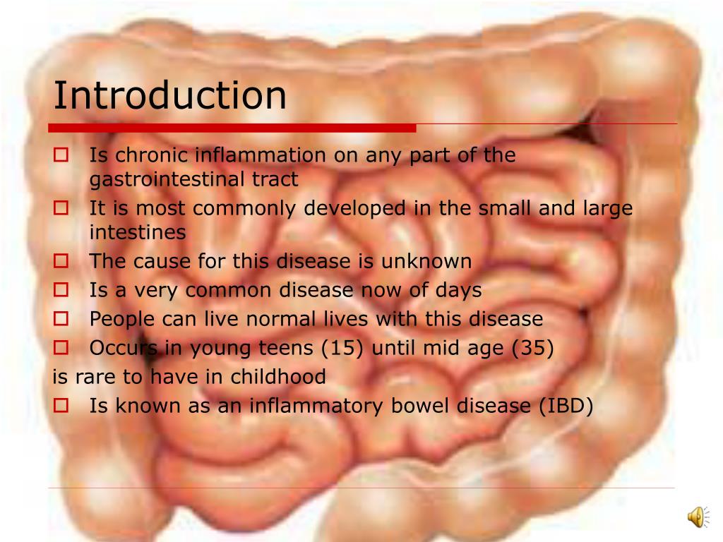 PPT Crohn’s Disease PowerPoint Presentation, free download ID4954621