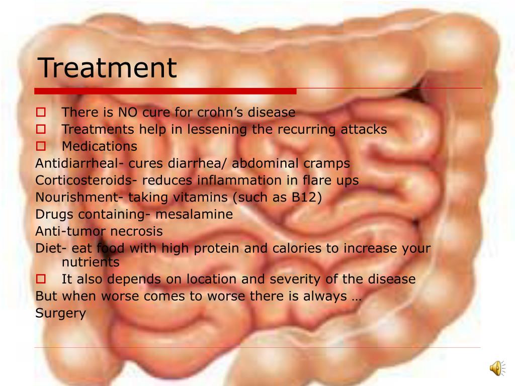 PPT Crohn’s Disease PowerPoint Presentation, free download ID4954621
