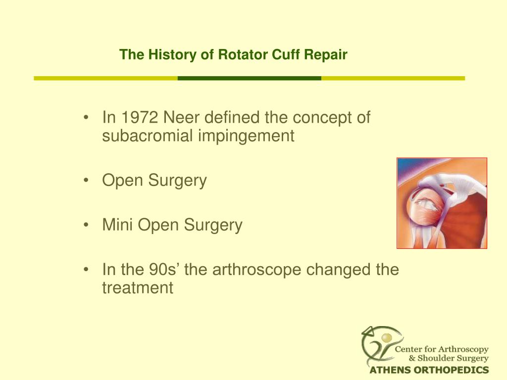 PPT Rotator Cuff Tears Indications of arthroscopic treatment an
