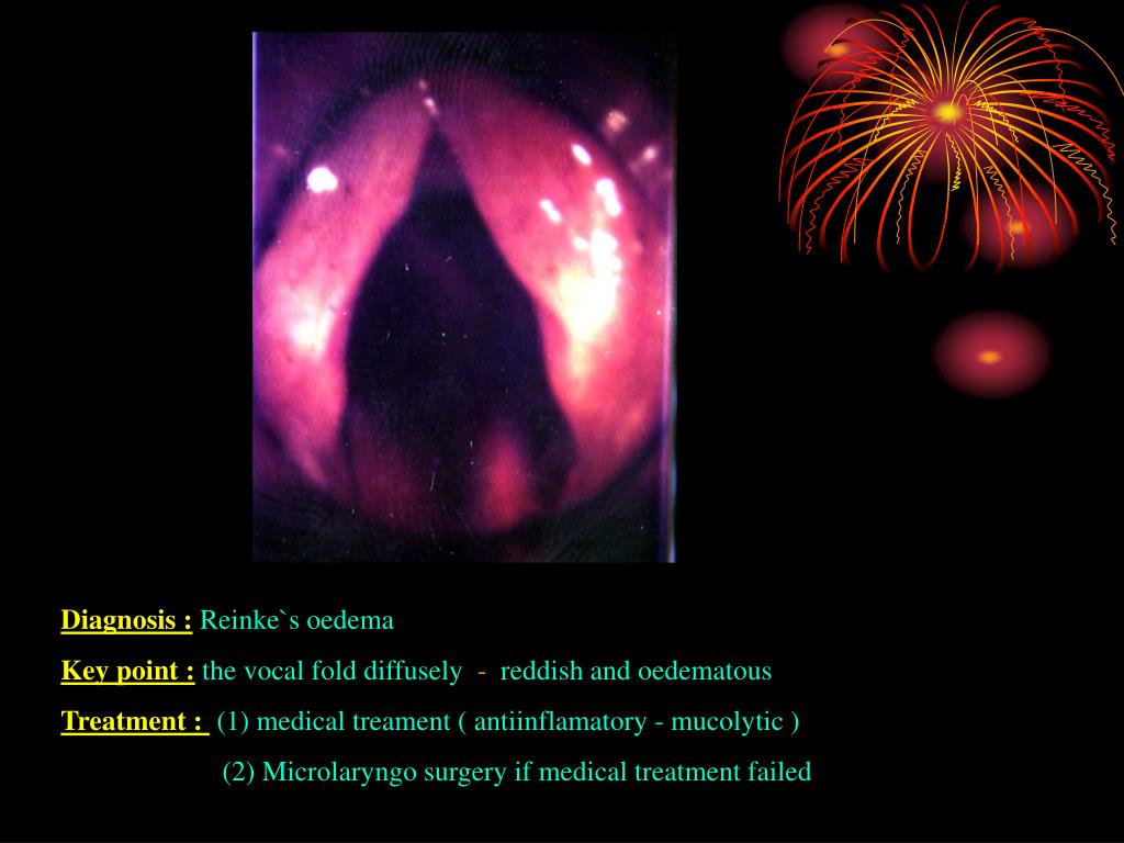 PPT Guide to PowerPoint Presentation, free download ID4972863