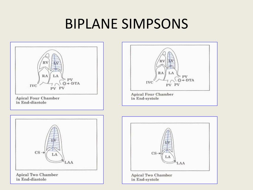 PPT EVALUATION OF SYSTOLIC FUNCTION OF LEFT VENTRICLE BY