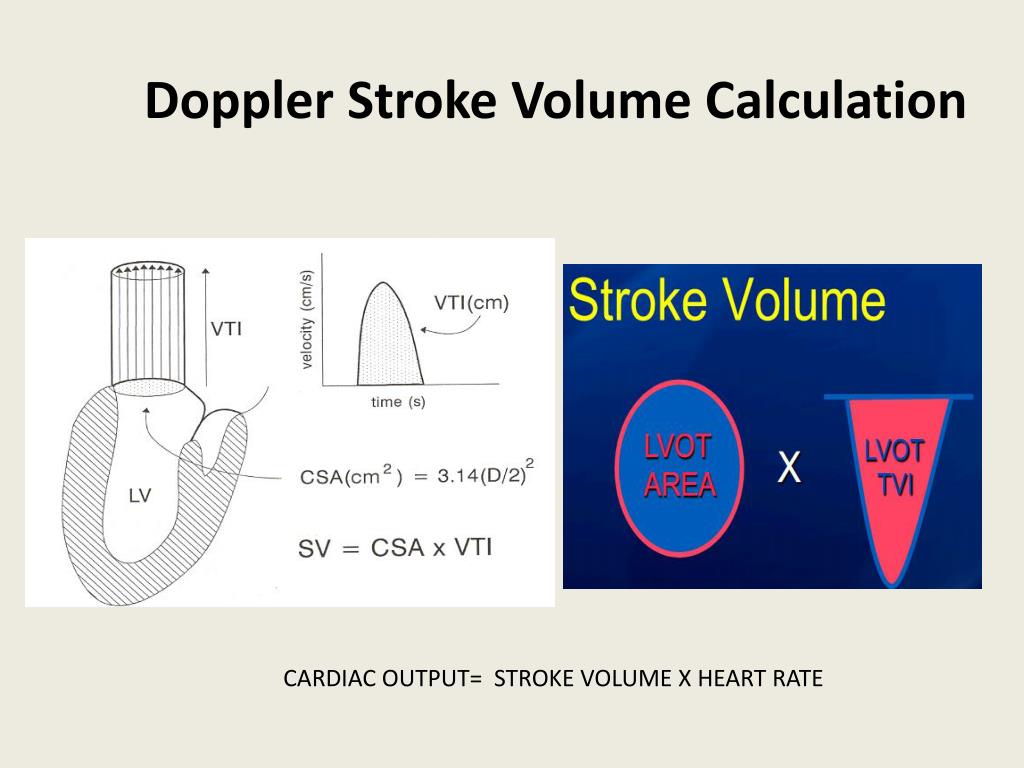 PPT EVALUATION OF SYSTOLIC FUNCTION OF LEFT VENTRICLE BY