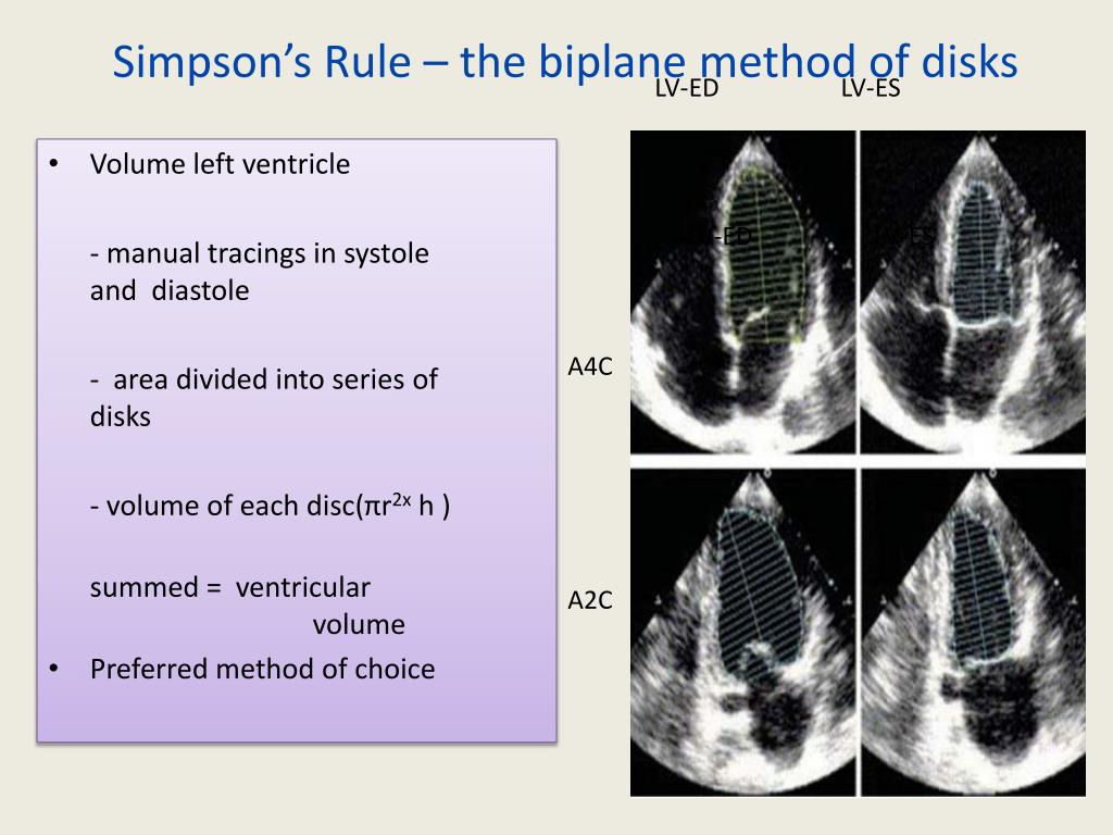 PPT EVALUATION OF SYSTOLIC FUNCTION OF LEFT VENTRICLE BY