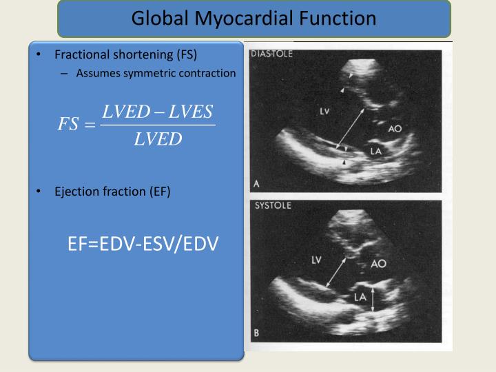 PPT EVALUATION OF SYSTOLIC FUNCTION OF LEFT VENTRICLE BY
