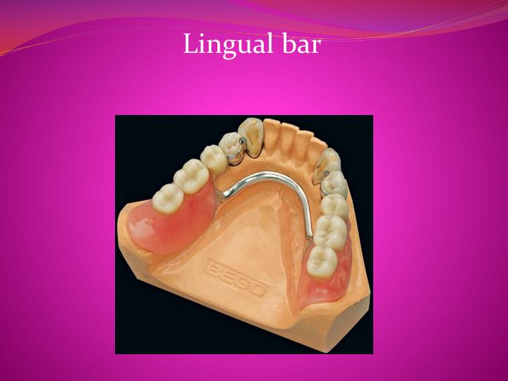 PPT Removable Partial Dentures PowerPoint Presentation ID5042388