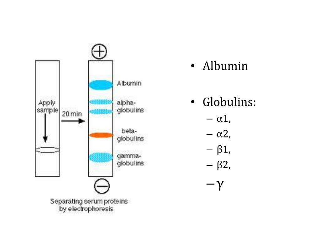PPT Serum Electrophoresis AND IMMUNOFIXATION june 2013 PowerPoint