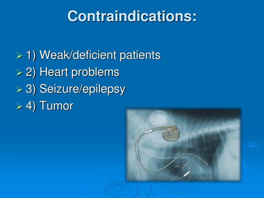 PPT Introduction to Acupuncture Techniques PowerPoint Presentation