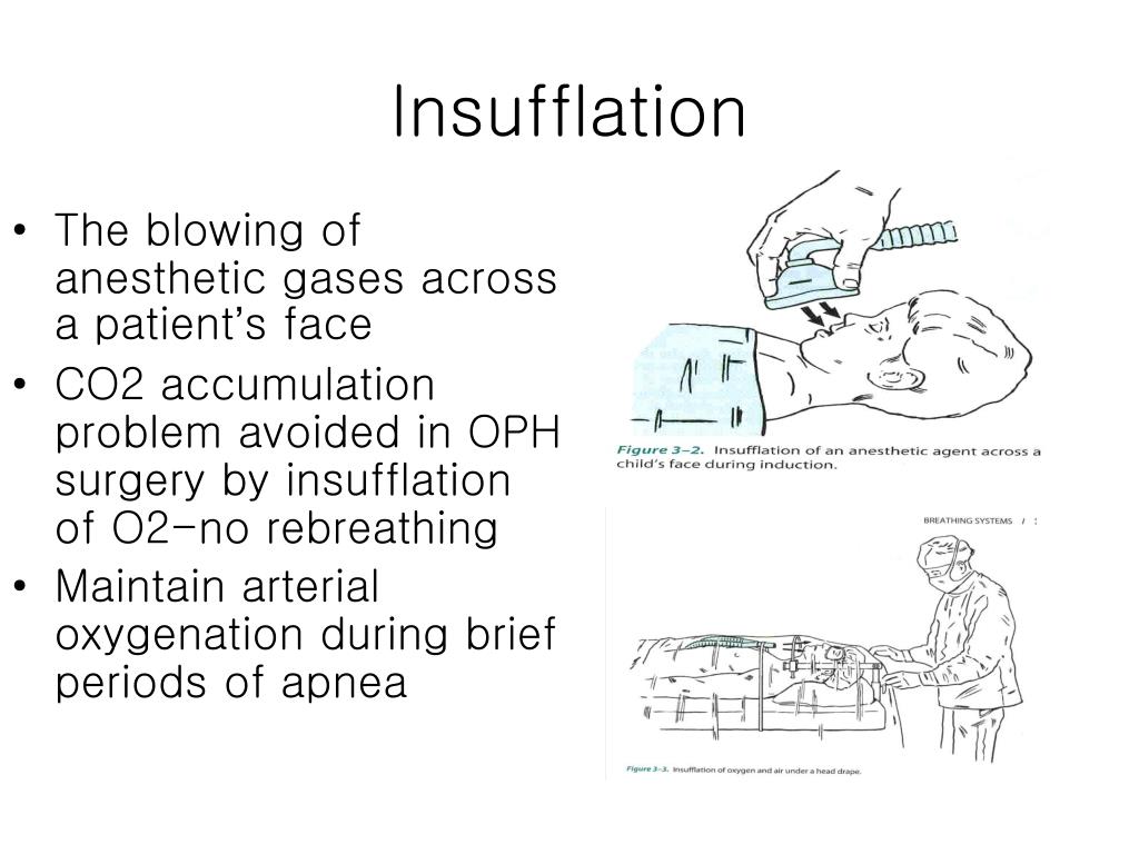 PPT 3. Breathing Systems Anesthesia PowerPoint Presentation, free download ID5137497