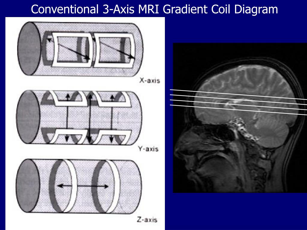 PPT My spin on MRI The basics of MRI physics and image formation