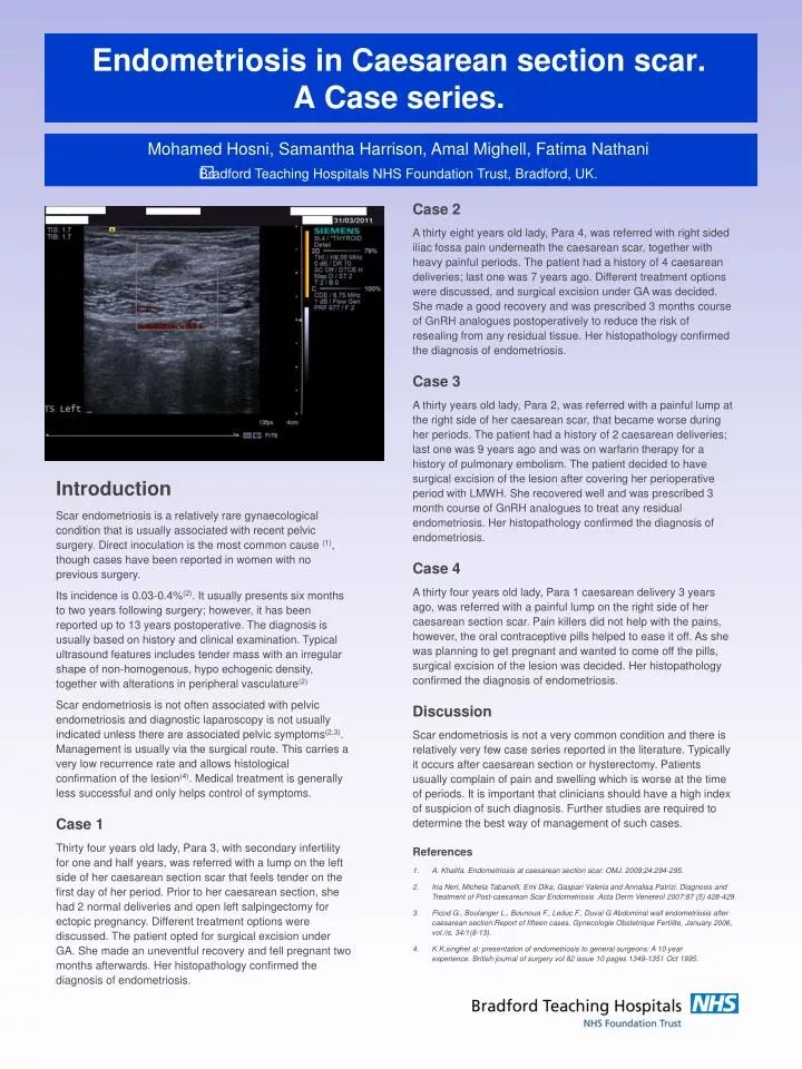 PPT Endometriosis in Caesarean section scar. A Case series
