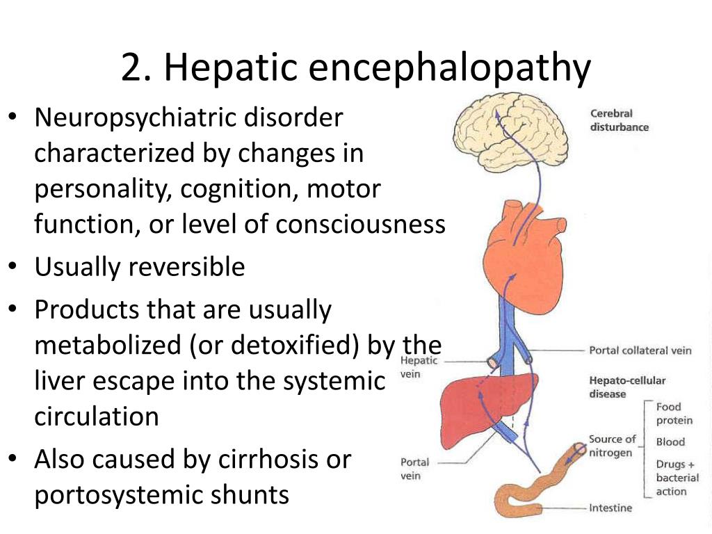 PPT LIVER CIRRHOSIS AND ITS COMPLICATIONS PowerPoint Presentation