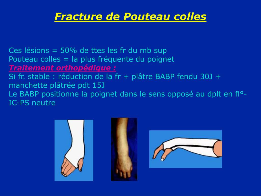 PPT Fractures de l’avantbras PowerPoint Presentation, free download