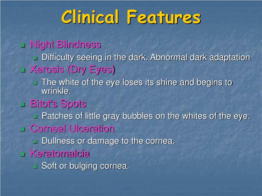 PPT Xerophthalmia PowerPoint Presentation, free download ID5180657