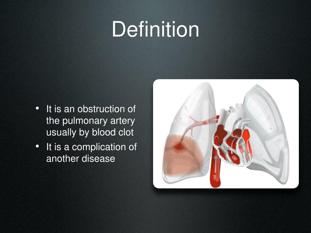 PPT Pulmonary Embolism PowerPoint Presentation, free download ID5192264