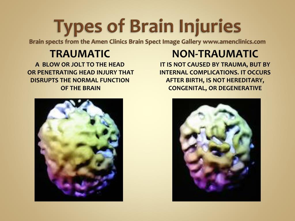 PPT Lori Leininger Certified Brain Injury Specialist (CBIS) PANDA