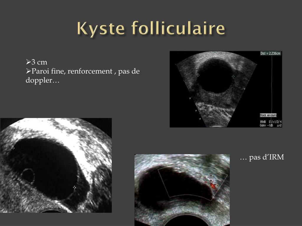 PPT IRM PELVIENNE Pour les nuls PowerPoint Presentation, free