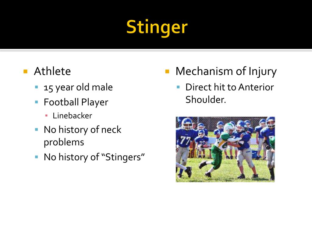 PPT Brachial Plexus Injury “Stinger” PowerPoint Presentation, free
