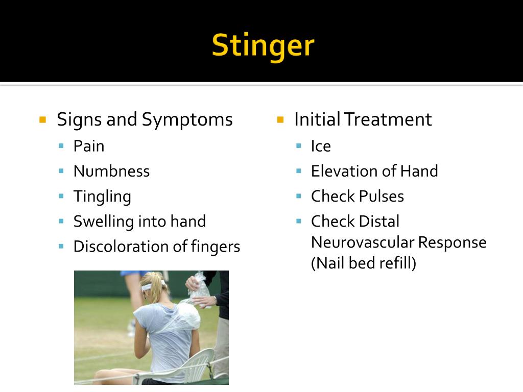 PPT Brachial Plexus Injury “Stinger” PowerPoint Presentation, free