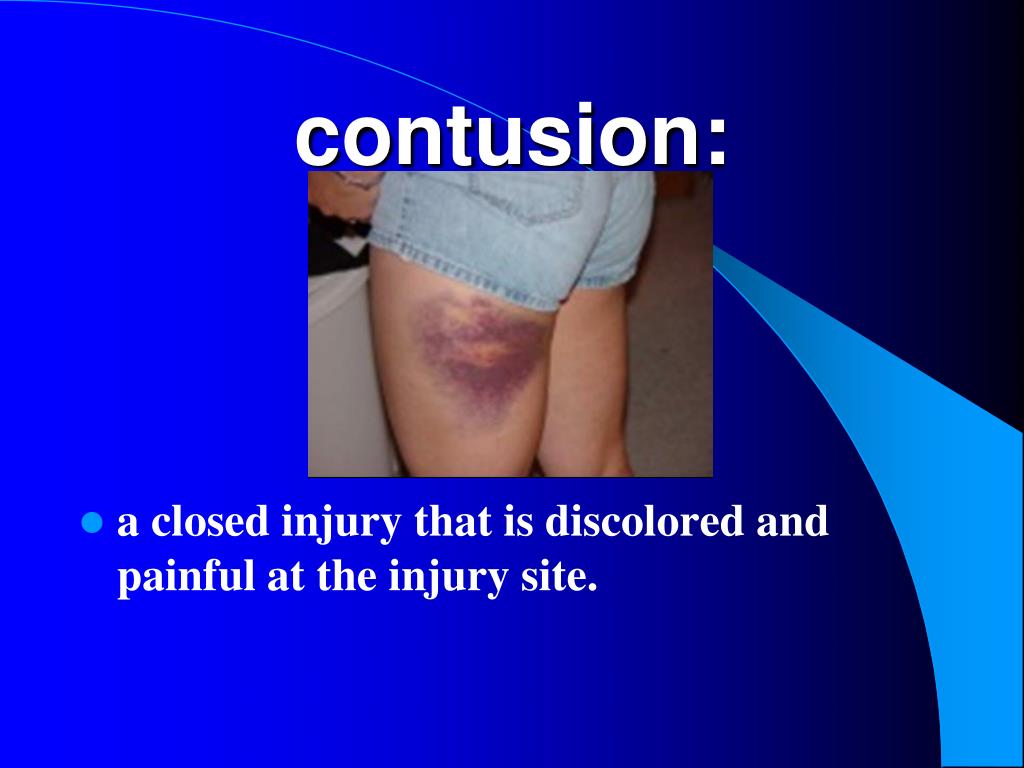 PPT abandonment PowerPoint Presentation, free download ID5303536