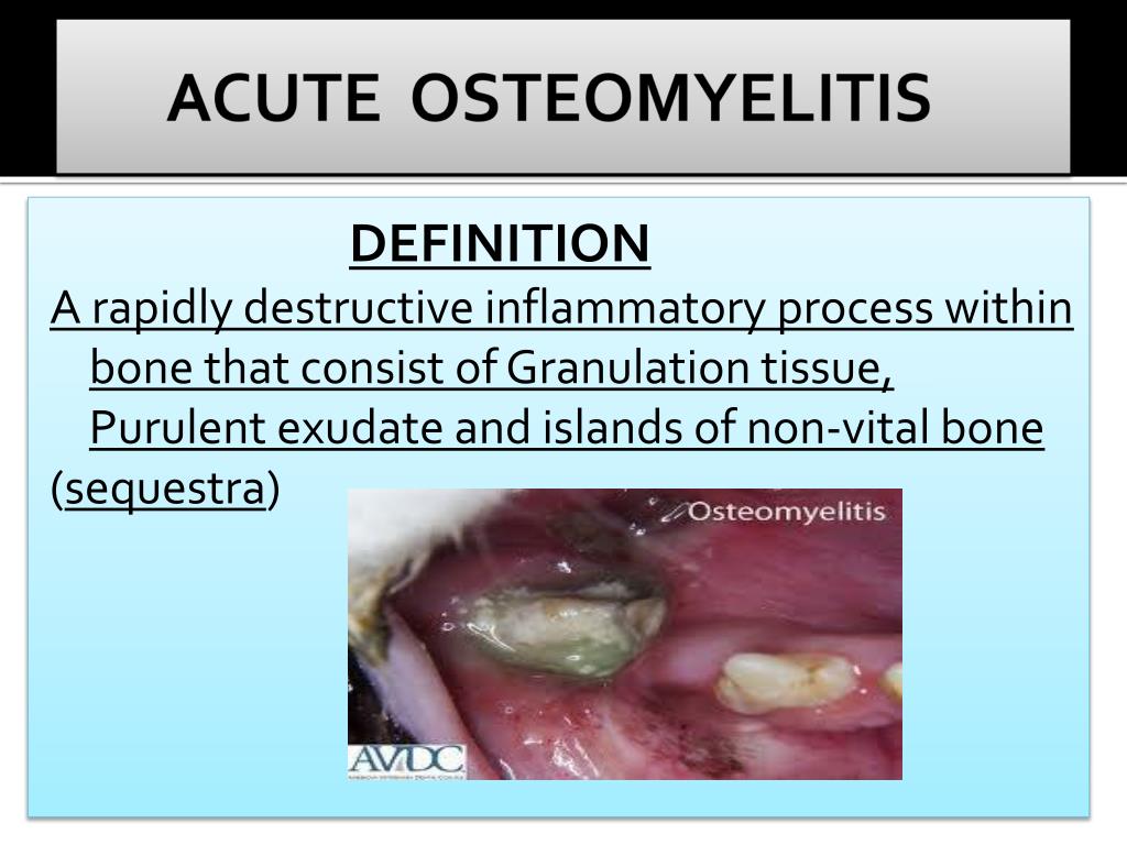 PPT DISORDERS OF MAXILLA AND MANDIBLE PowerPoint Presentation, free download ID5309607