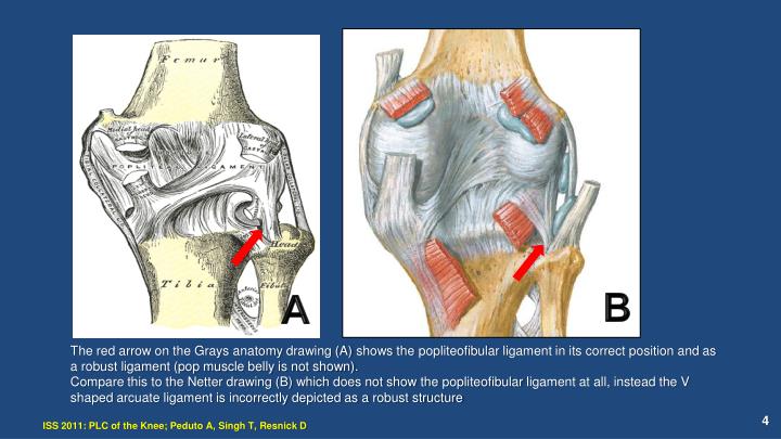 PPT Posterolateral Corner of the Knee MRI, Anatomy