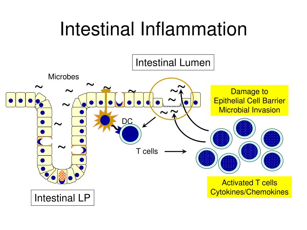 PPT Inflammatory Bowel Disease PowerPoint Presentation, free download
