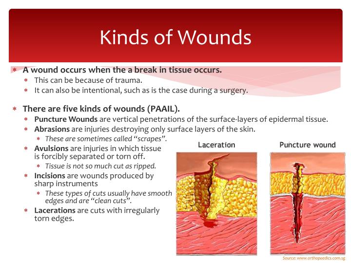 PPT Wound Repair PowerPoint Presentation ID5323746