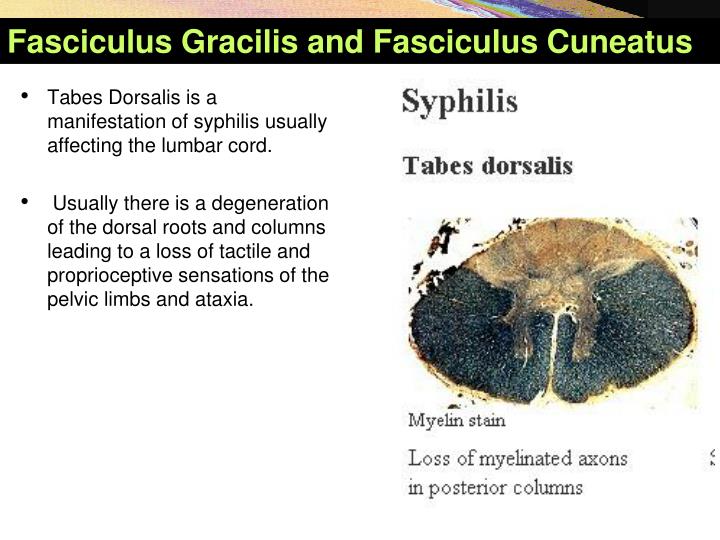 PPT Ascending Tracts of the Spinal Cord PowerPoint Presentation ID