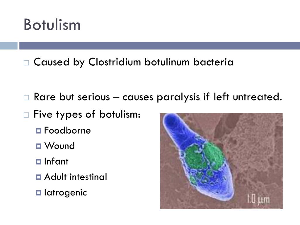 PPT BACTERIA PowerPoint Presentation, free download ID5349977