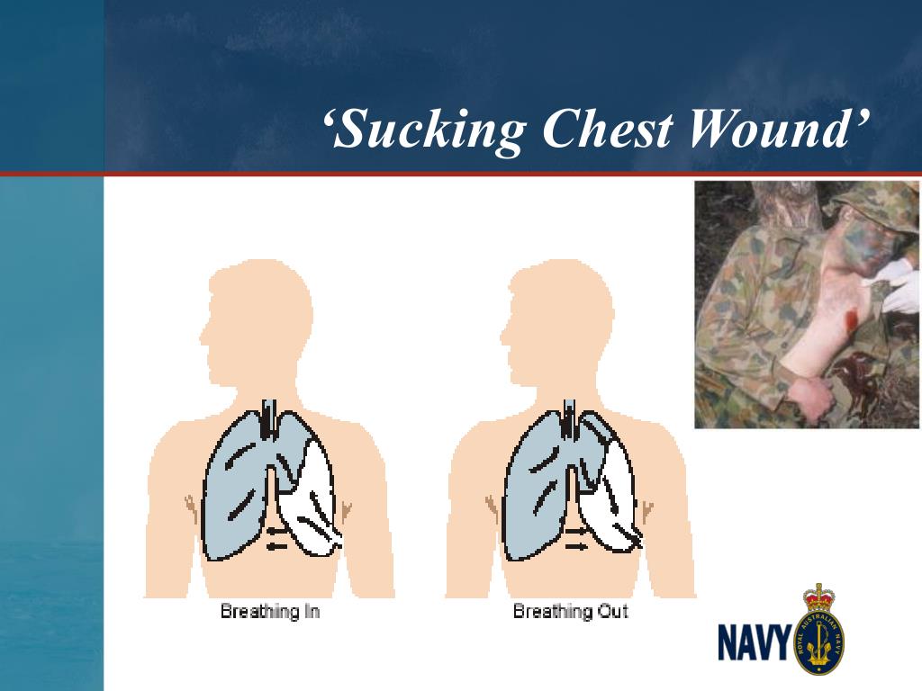 PPT FIRST AID MEDICAL CONDITIONS PowerPoint Presentation, free