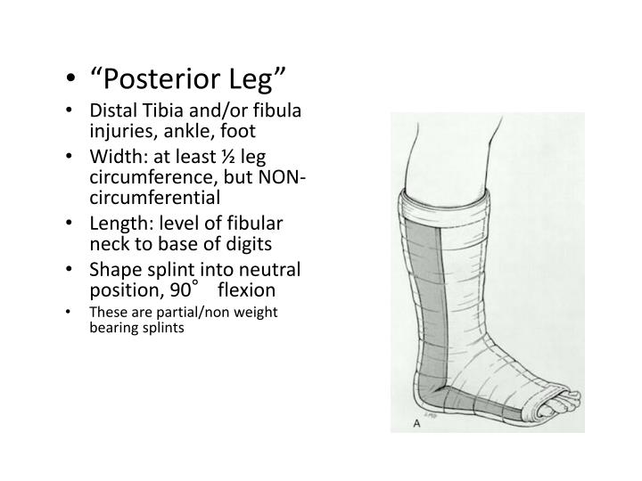 PPT Splinting PowerPoint Presentation ID5364828
