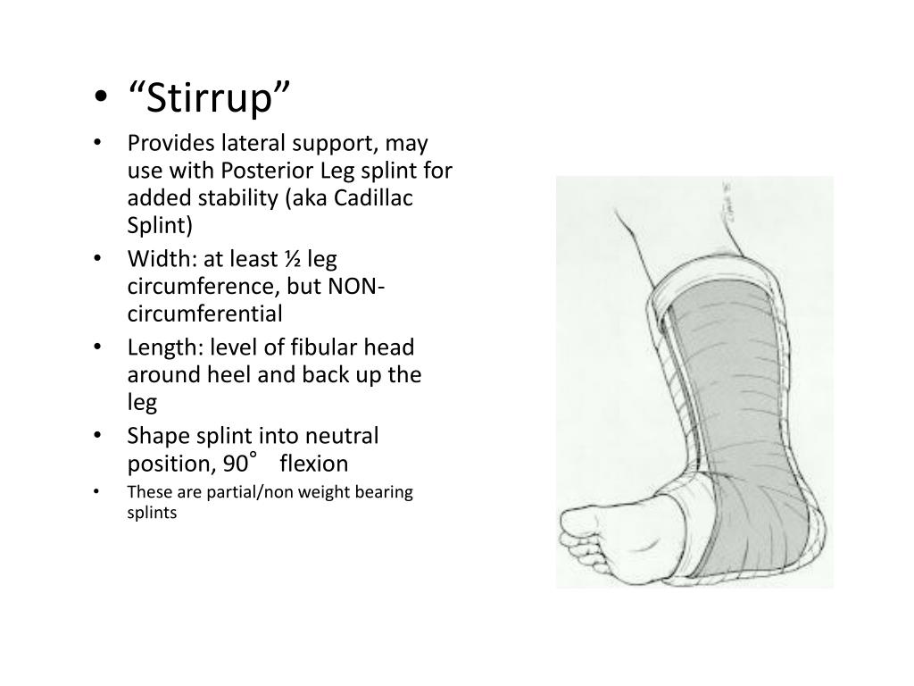 PPT Splinting PowerPoint Presentation, free download ID5364828