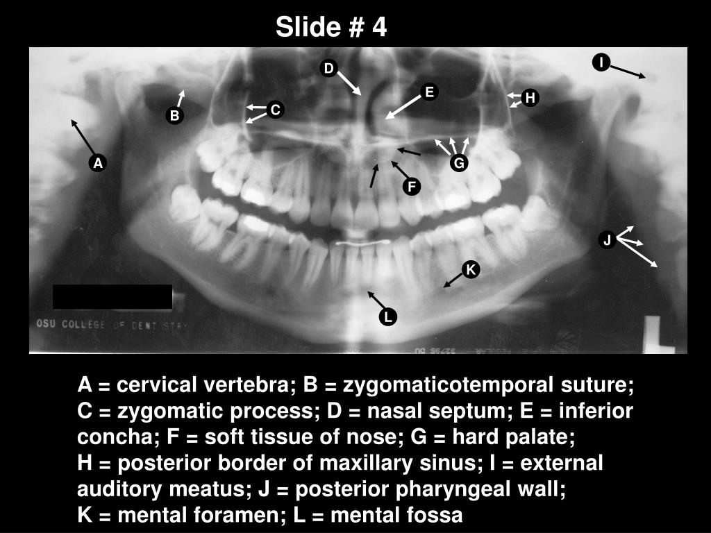 PPT Panoramic Anatomy PowerPoint Presentation, free download ID5372621