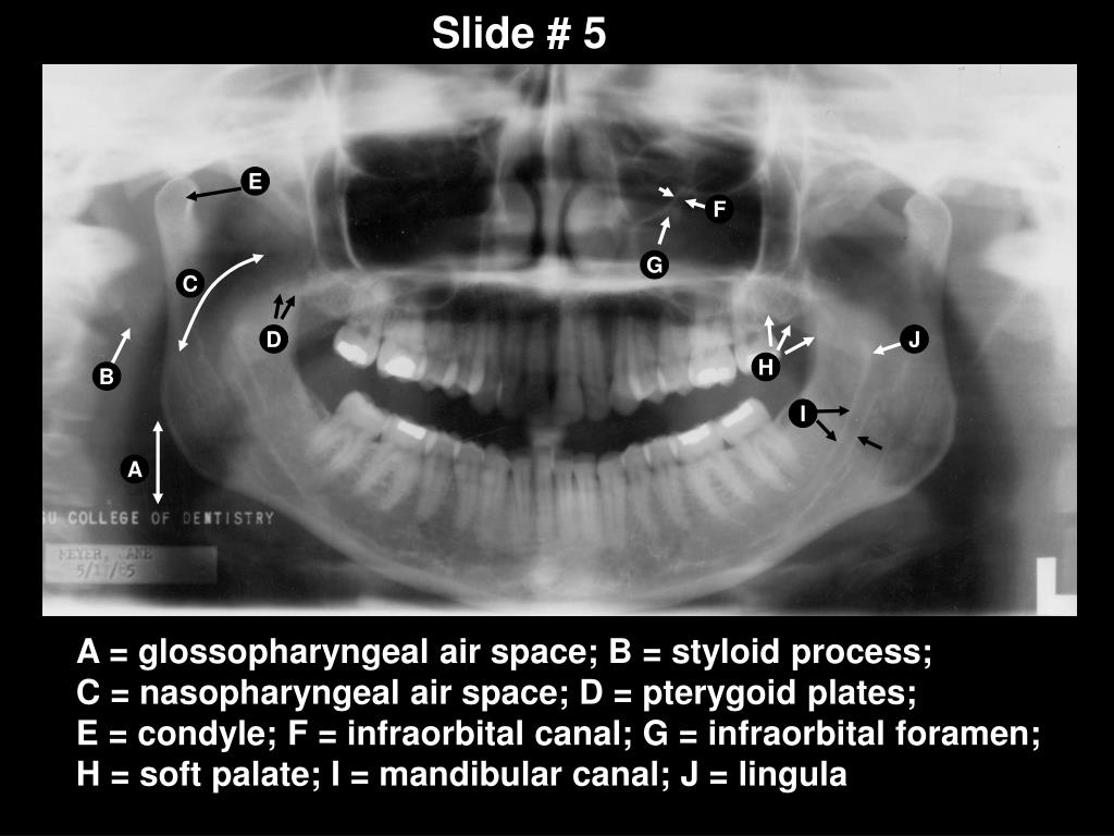 PPT Panoramic Anatomy PowerPoint Presentation, free download ID5372621