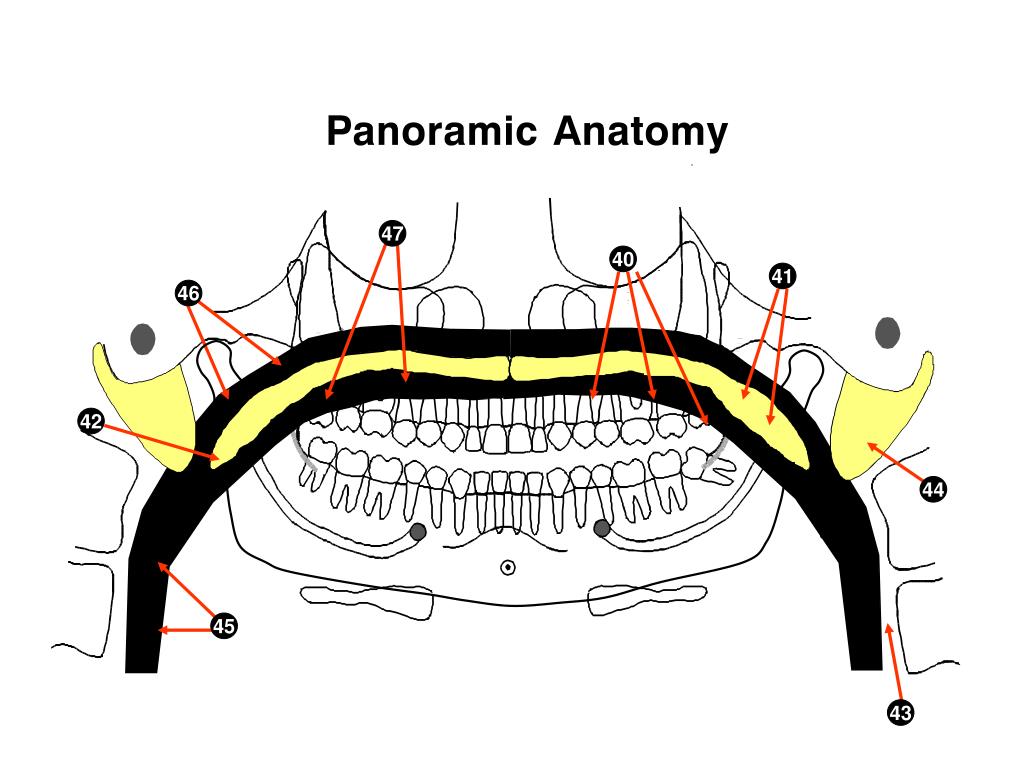 PPT Panoramic Anatomy PowerPoint Presentation, free download ID5372621