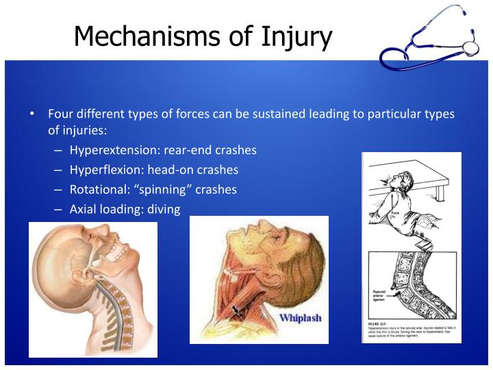 PPT Spinal/Neck Trauma PowerPoint Presentation ID5384177