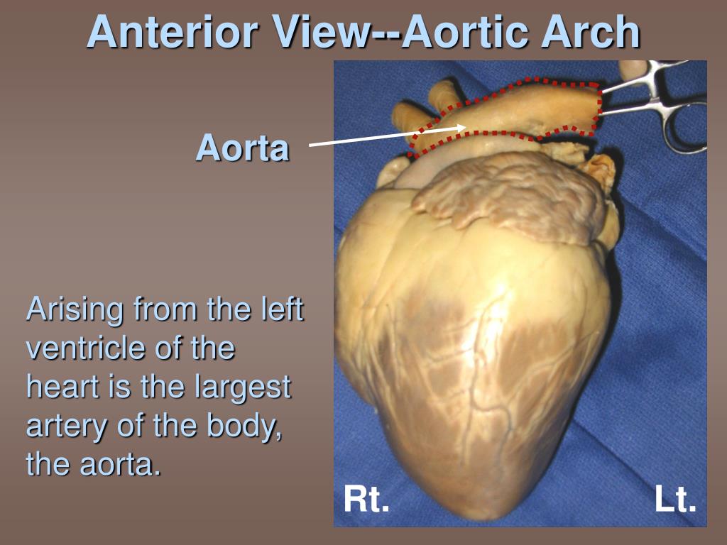 PPT Sheep Heart Dissection 101 PowerPoint Presentation, free download