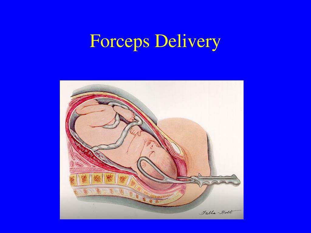 PPT Abnormal Labor PowerPoint Presentation, free download ID5405938