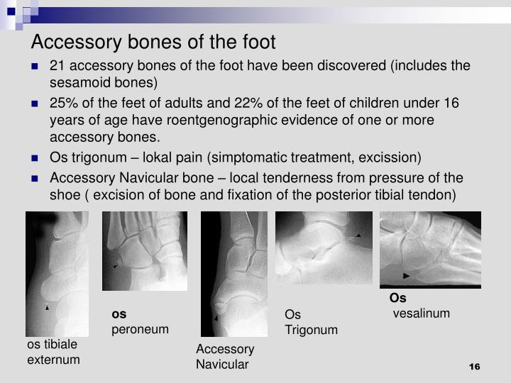 PPT Disorders of the ankle and foot PowerPoint Presentation ID5406648